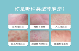 运动与荨麻疹：选对方式，既能健身又能防复发